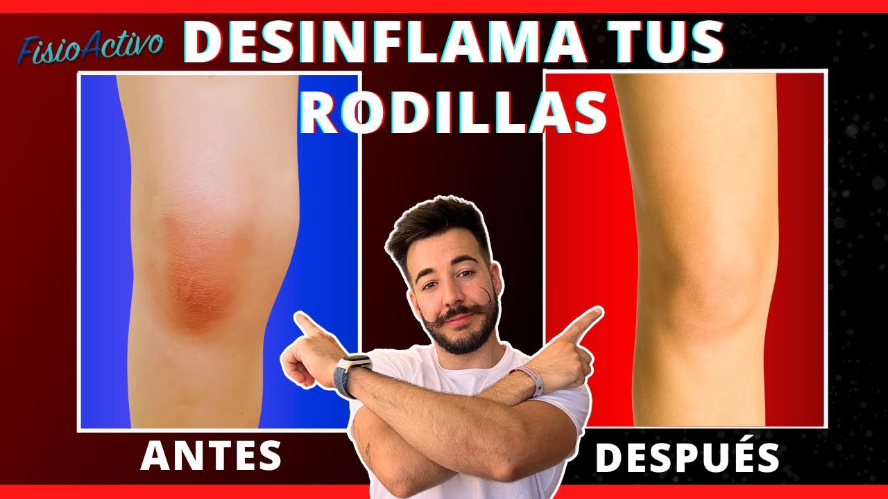 Cómo DESINFLAMAR LAS RODILLAS y eliminar el LÍQUIDO: Haz estos 5 EJERCICIOS