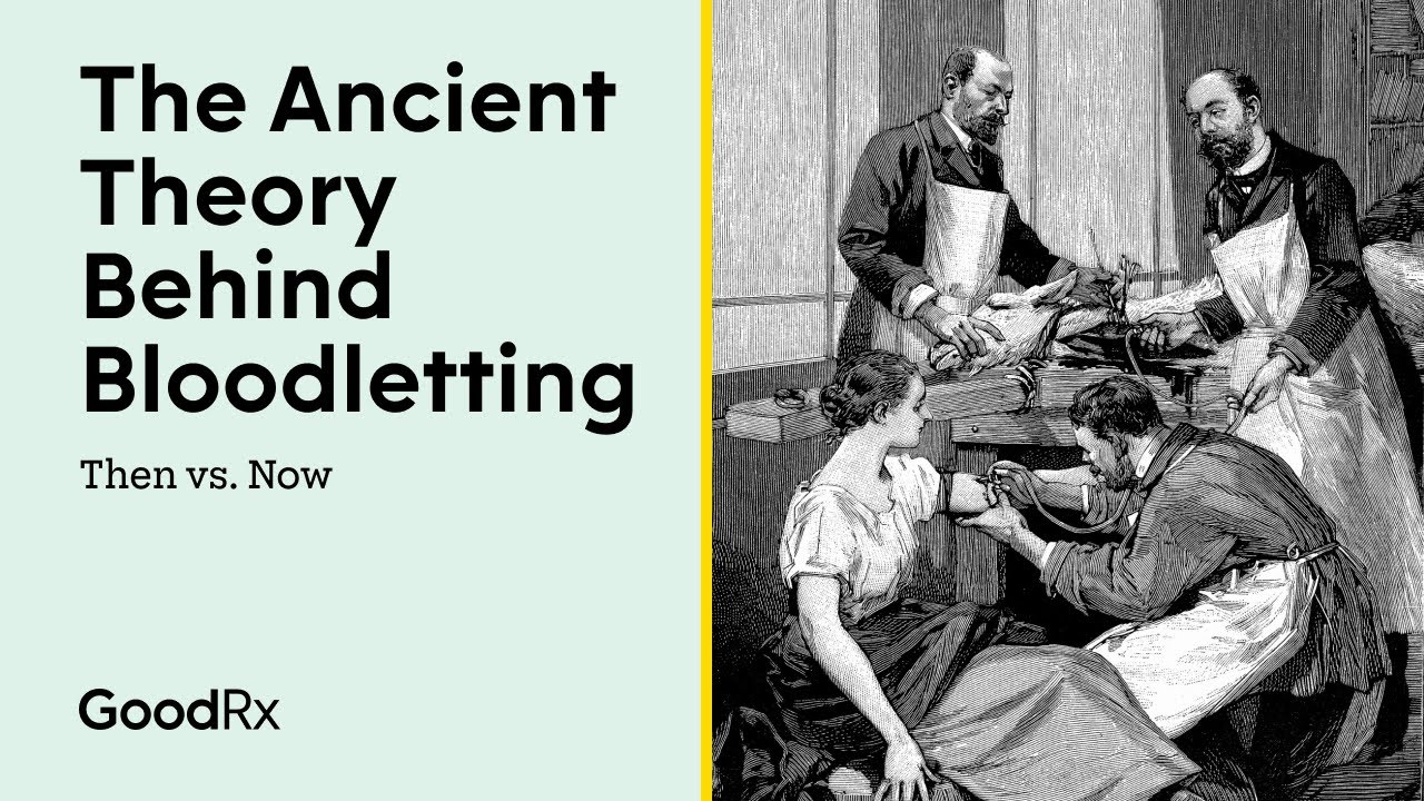 Bloodletting (Phlebotomy) Through the Ages | Then vs. Now | GoodRx