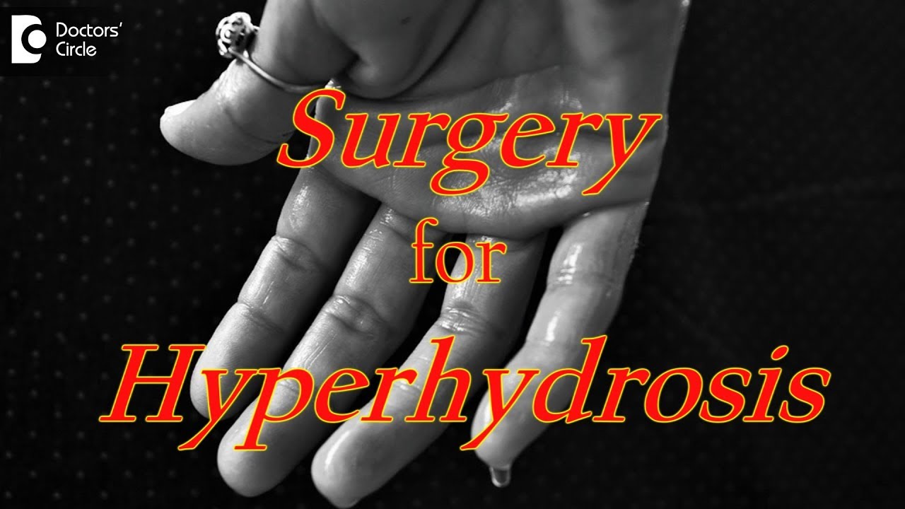 When is surgery needed for treating Hyperhidrosis? - Dr. Rajdeep Mysore