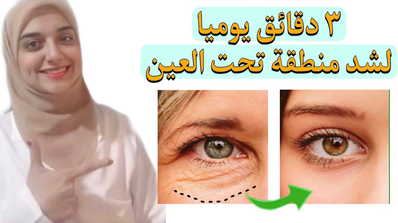 ازاله التجاعيد حول العين/ اقوى طريقة فعالك  لشد منطقه تحت العين في دقائق ..