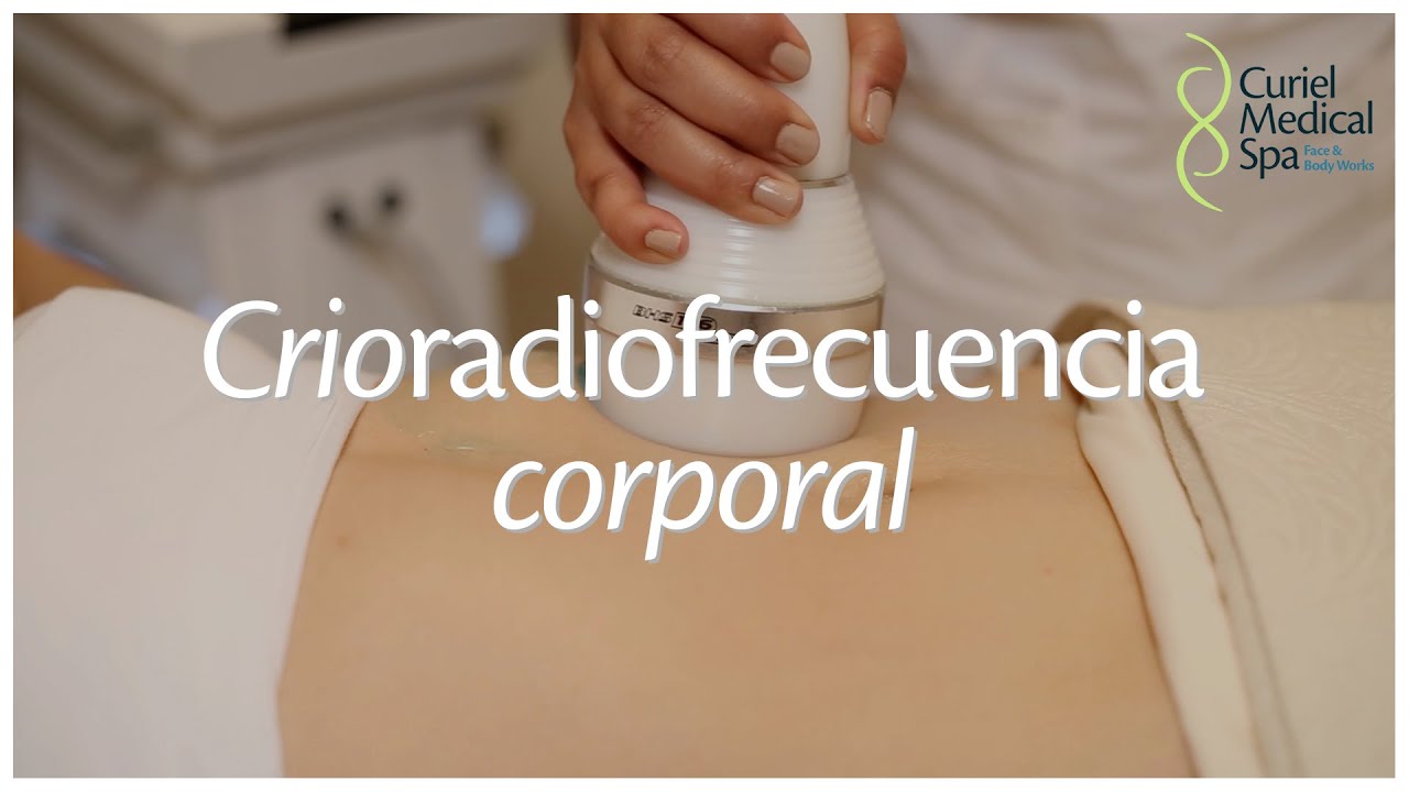 Tratamiento de Crioradiofrecuencia