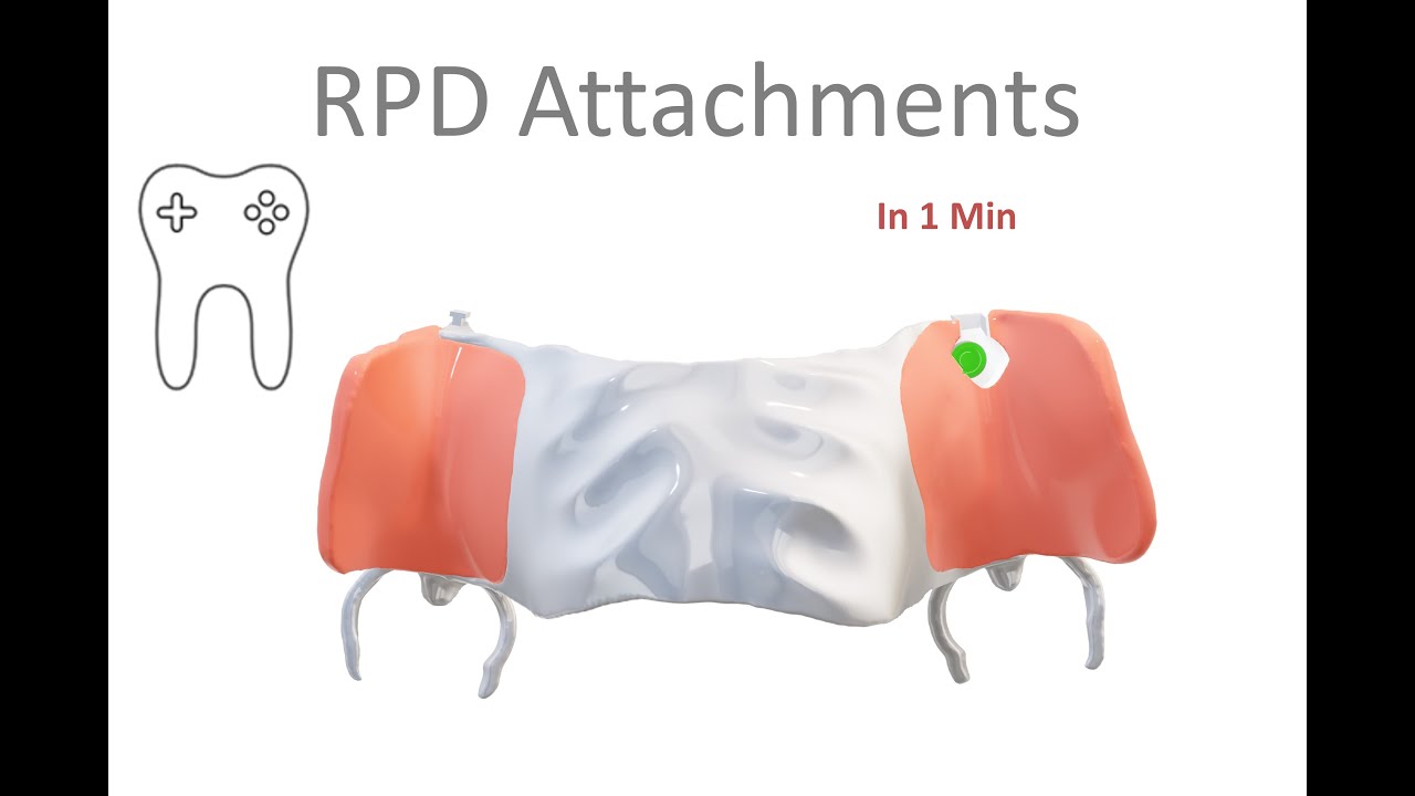 RPD attachments in 1 min