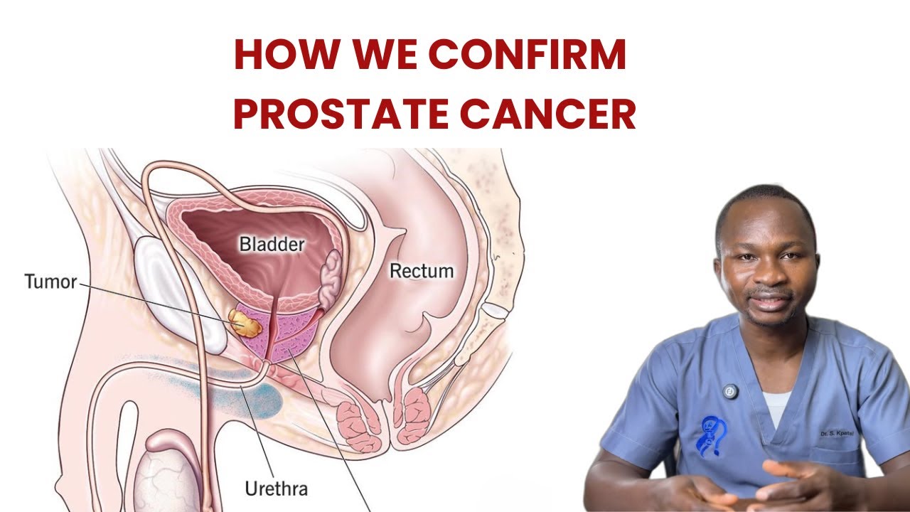 Prostate Cancer Diagnosis: MRI, Biopsy & Staging Explained