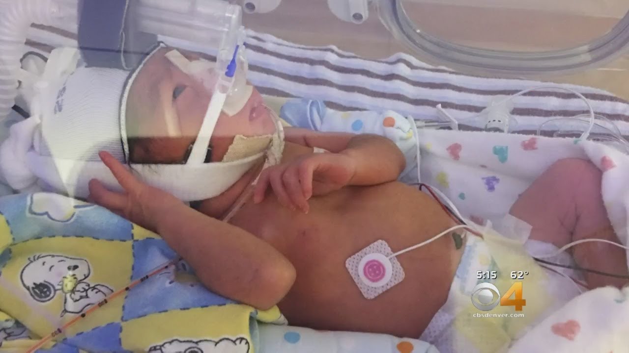 Mother And Baby Survive Serious Complications Linked To C-Sections