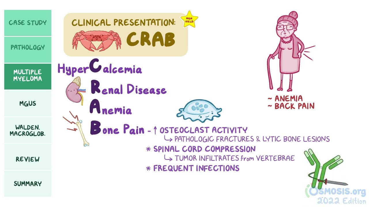 Plasma Cell Disorders | Hematology | Osmosis Pathology Review