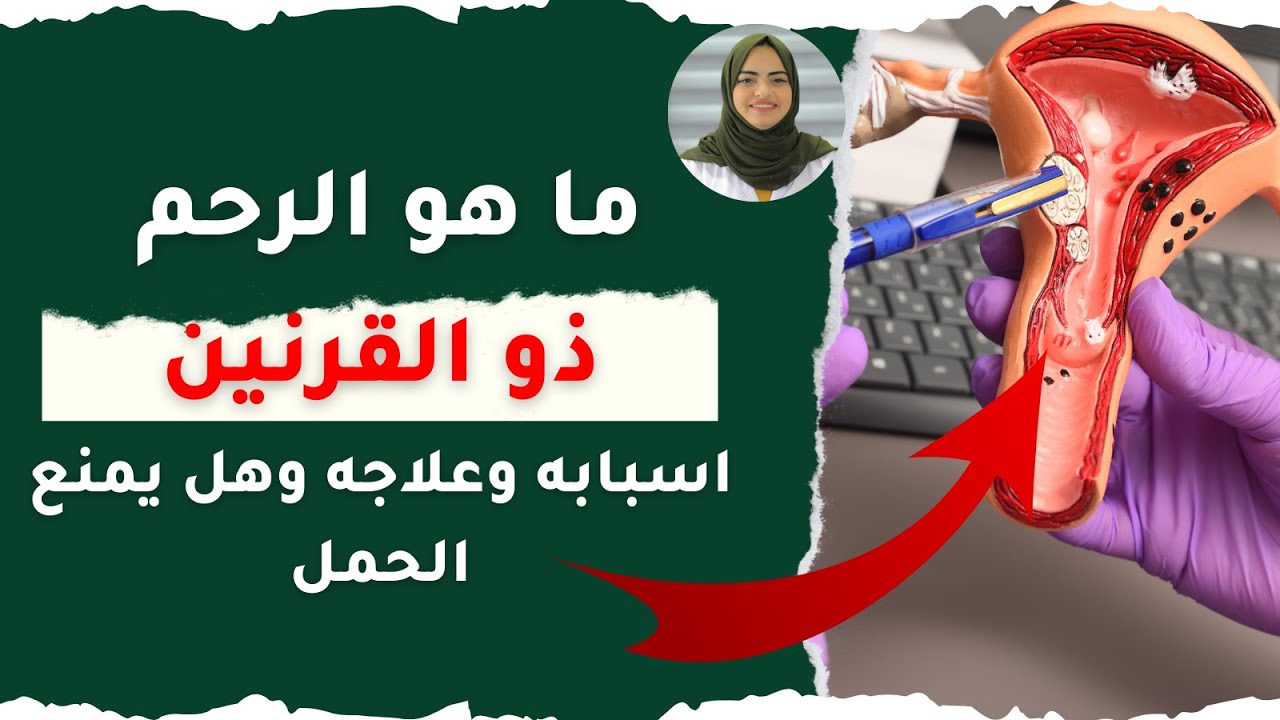 ما هو الرحم ذو القرنين اسبابه وعلاجه وهل يمنع الحمل