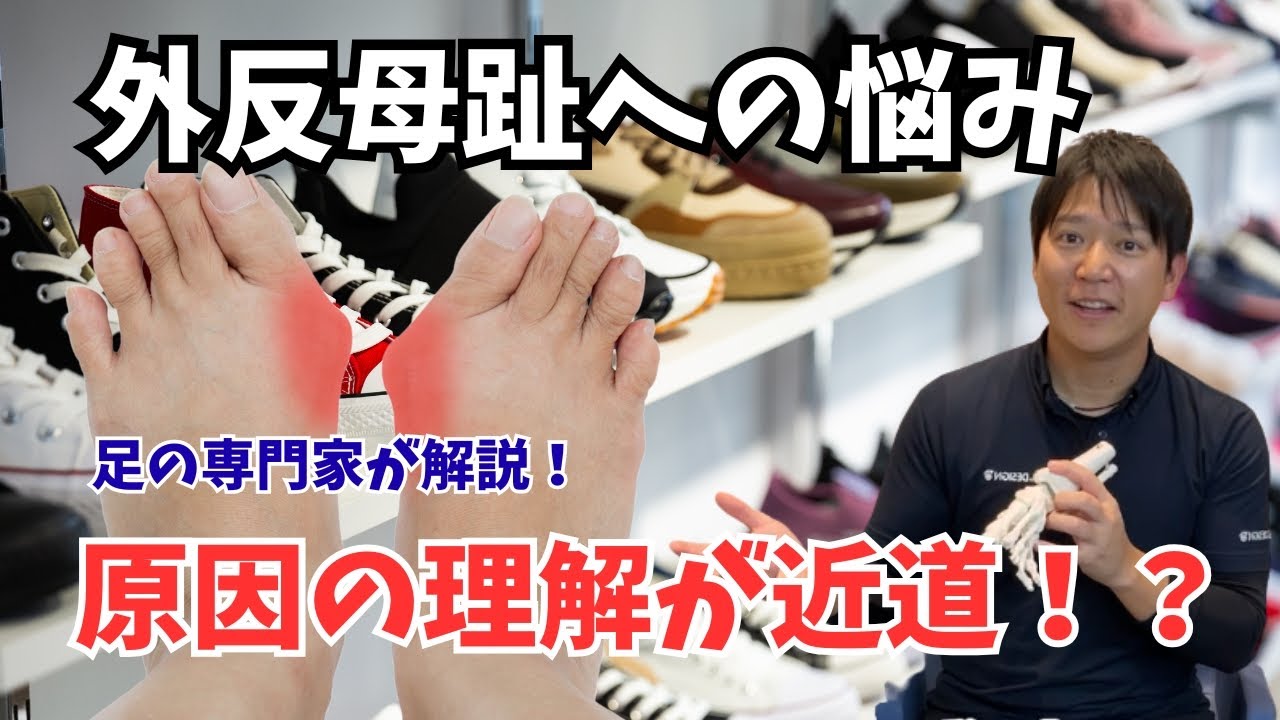 「【外反母趾の悩み】専門家が徹底解説！原因の理解が一番の近道？！」