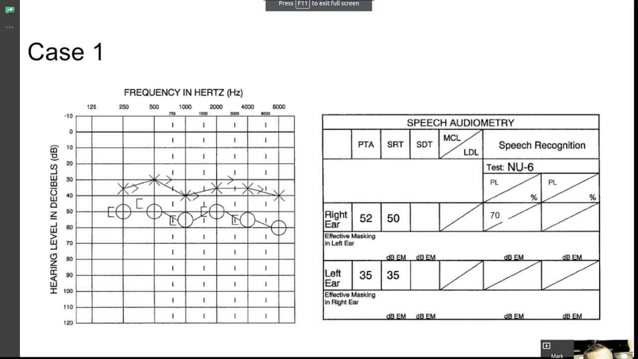 speech audiometry practice