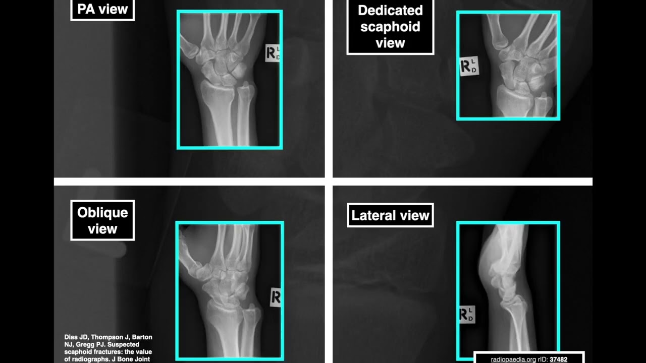 MSK Radiology series - Part 6