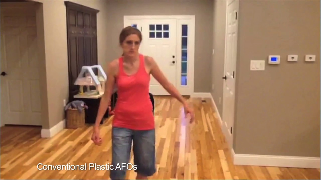 Part 1 (of 3) CMT: DBS Bracing Solutions: Stephanie shares her amazing experience