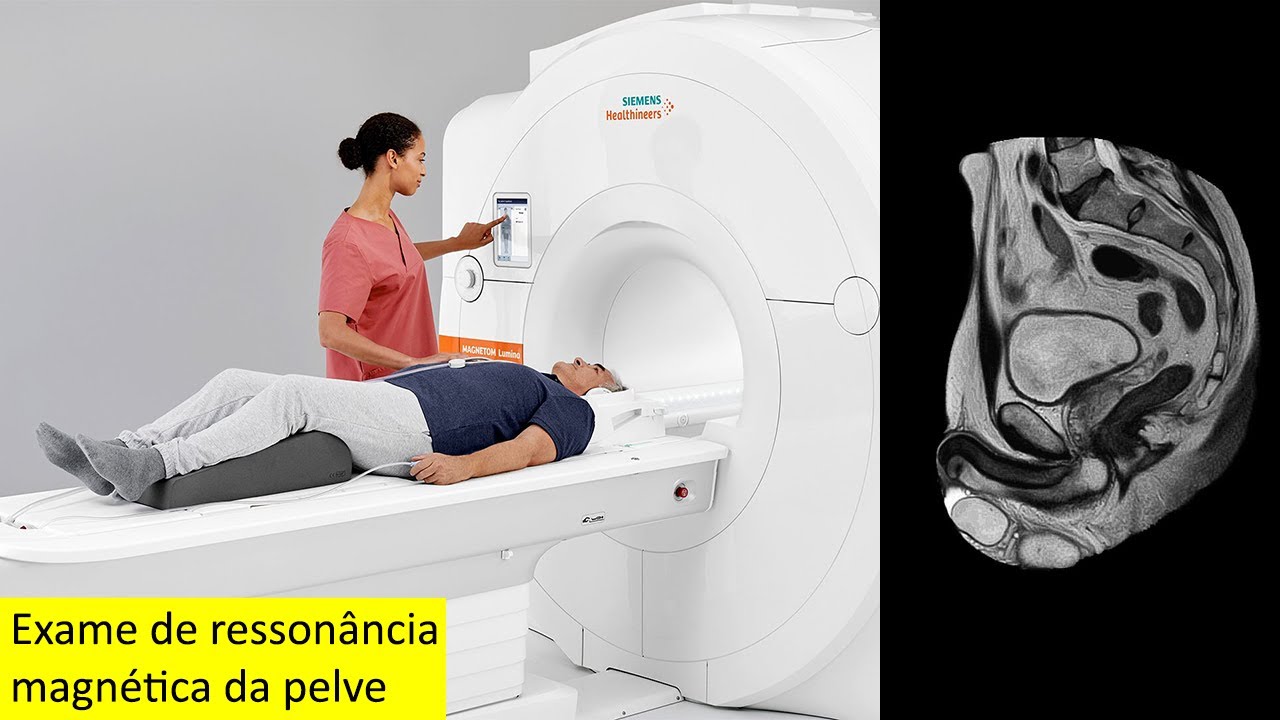 Exame de ressonância magnética da pelve