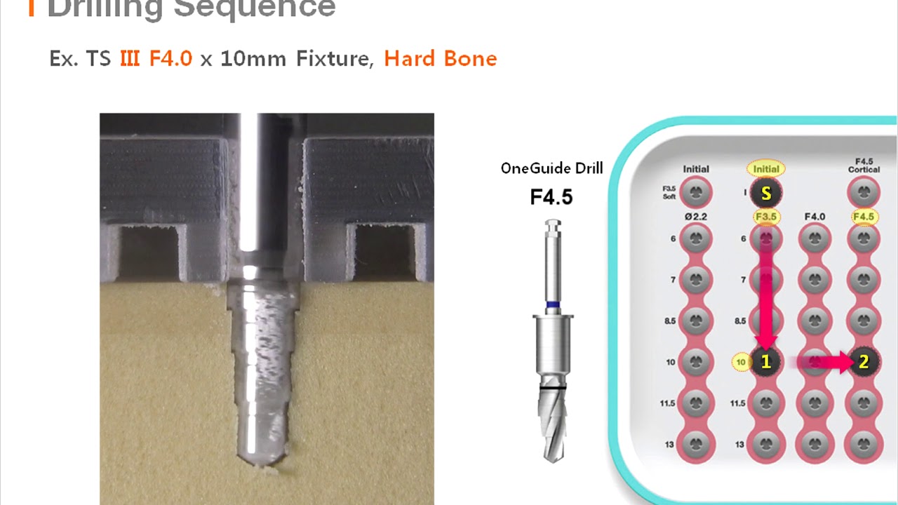 OneGuide KIT Drilling Sequence