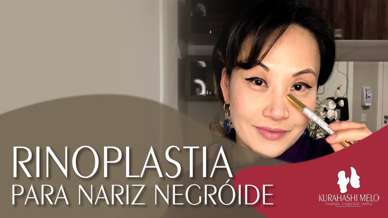 Rinoplastia para nariz negróide | Dra. Andreia Kurahashi Melo