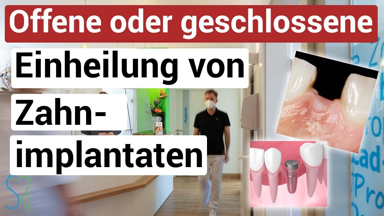 Implantate: Unterschied offene und geschlossene Einheilung [6 Punkte]