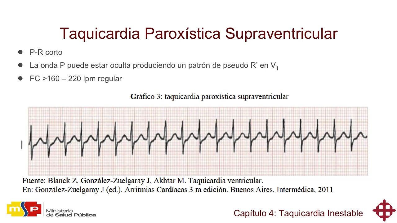 Clase 4 APH Taquicardias inestables