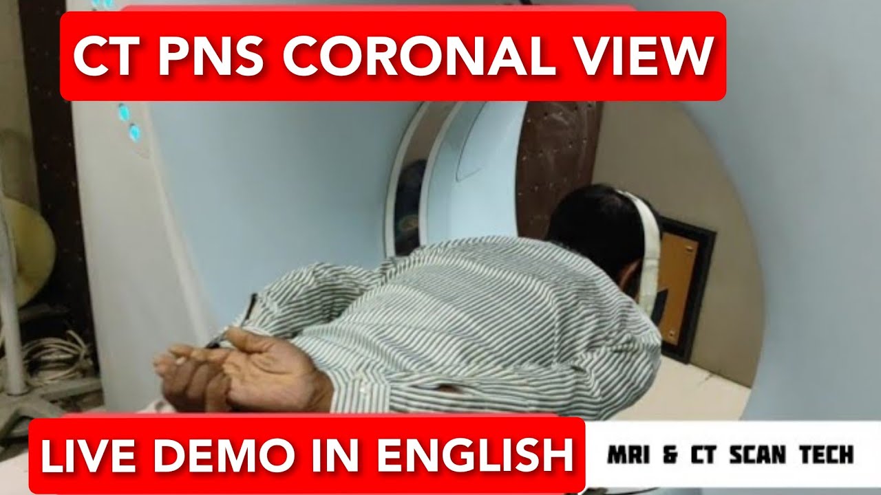 CT scan PNS Coronal scan Protocol | How to read PNS scan for Sinusitis | Live Demo in English.