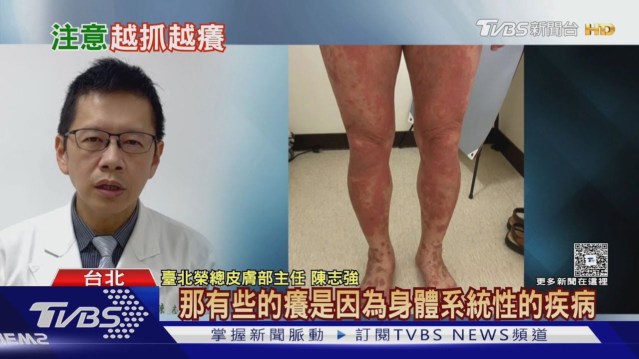 瘋狂抓不停? 皮膚癢其實是身體「這部位」　開始拉警報｜十點不一樣20251206 @TVBSNEWS02