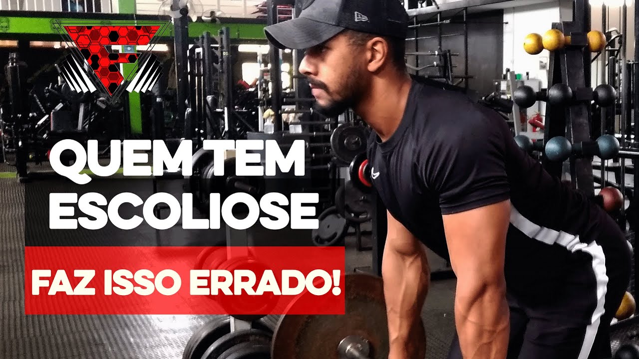 Como corrigir a assimetria das pernas de quem tem escoliose?
