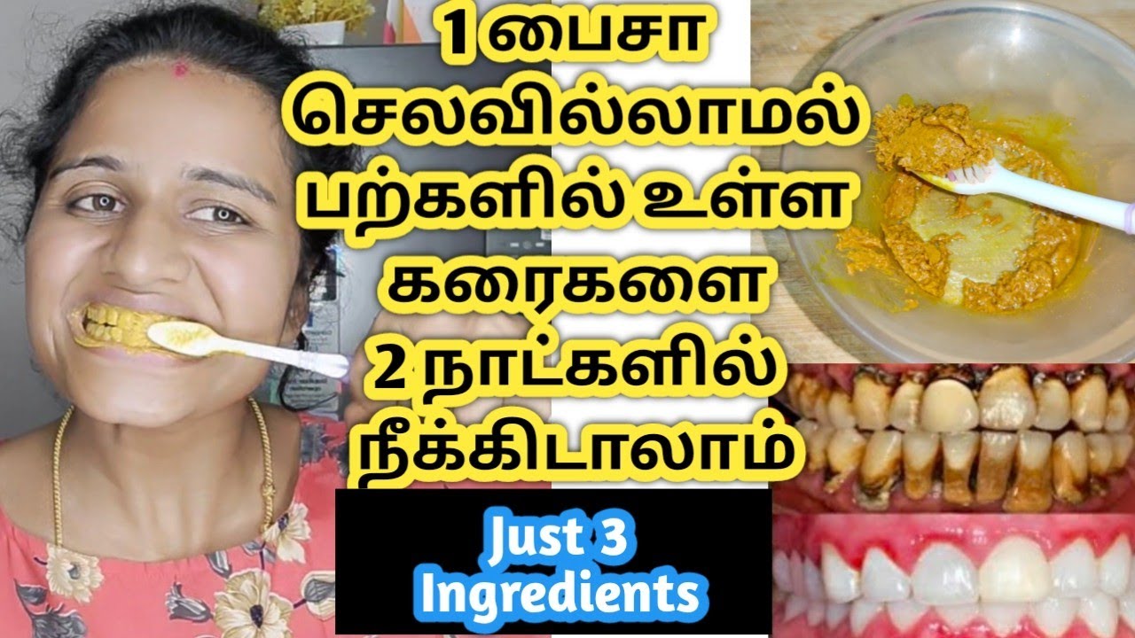 Teeth whitening at home/Whitening teeth home remedies/How to whiten teeth/மஞ்சள் பற்கள் வெள்ளையாக