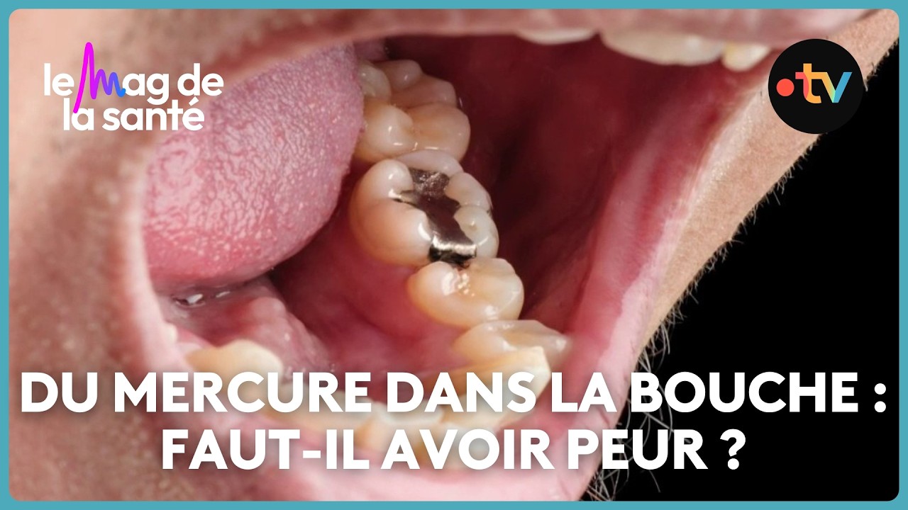 Faut-il faire remplacer ses vieux plombages ?