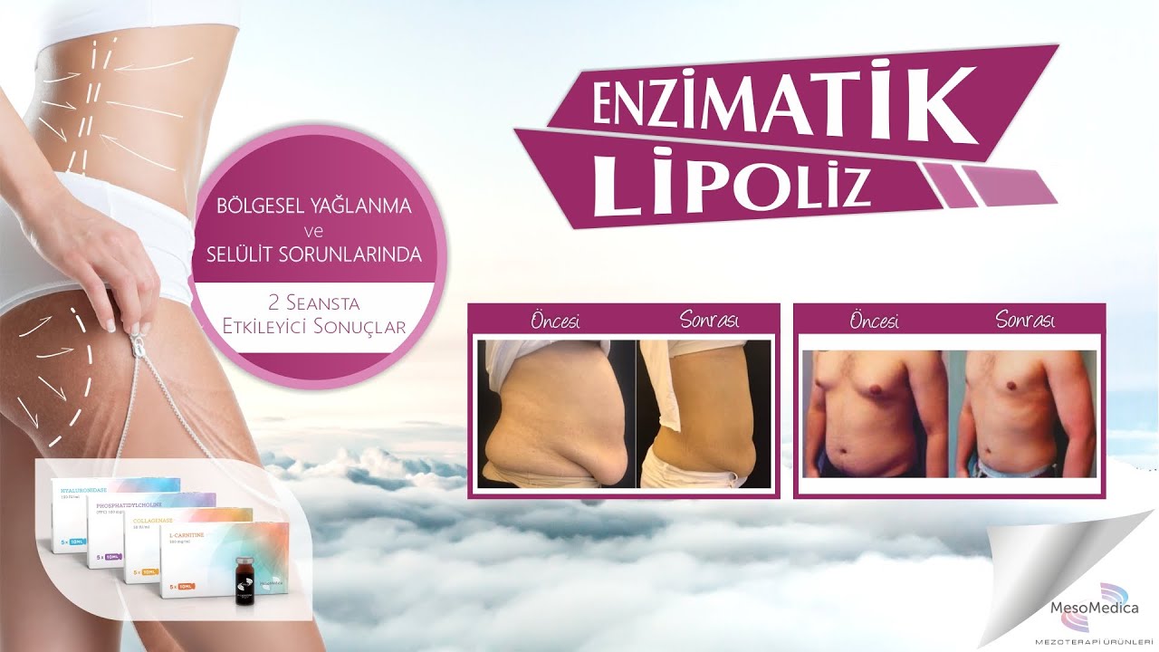 ENZİMATİK LİPOLİZ Bölgesel İncelme, Zayıflama ve Selülitte Etkin Sonuçlar. Uzm.Dr.Şafak Göktaş