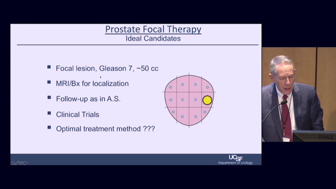 (6) Prostate Focal Therapy Summarized for the 2019 California Prostate Cancer Coalition Meeting
