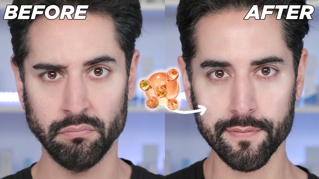 ad Your Most Hydrated Skin Ever? The New COSRX 5-PDRN Routine
