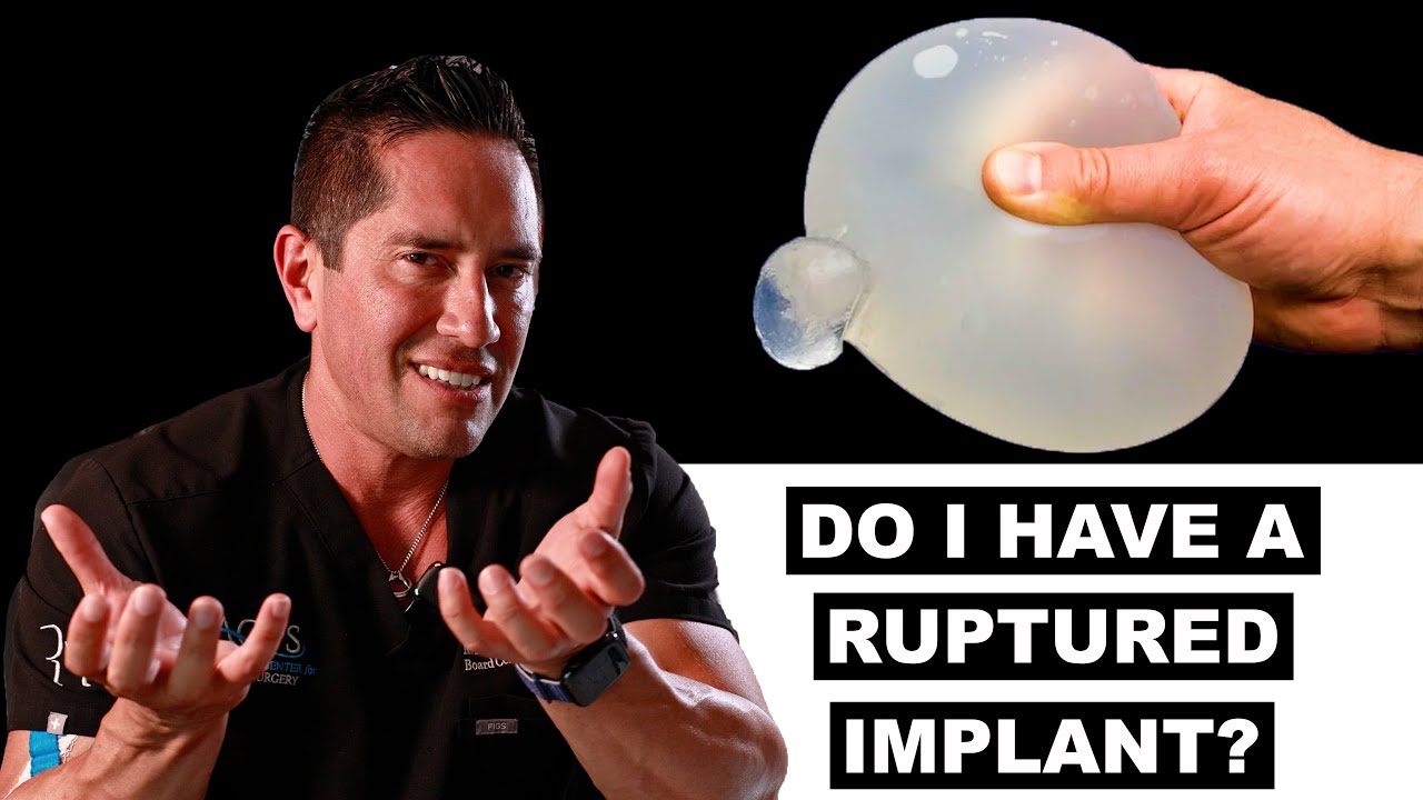 Do You Have a Ruptured Implant? Dr. Morales Explains the Warning Signs & What Happens Next!