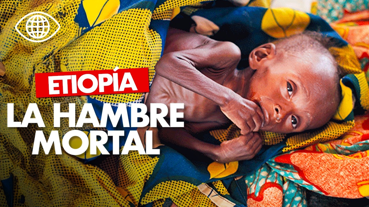 Tigray : la hambruna est&aacute; matando a miles de personas ⎮ Reportaje - AT