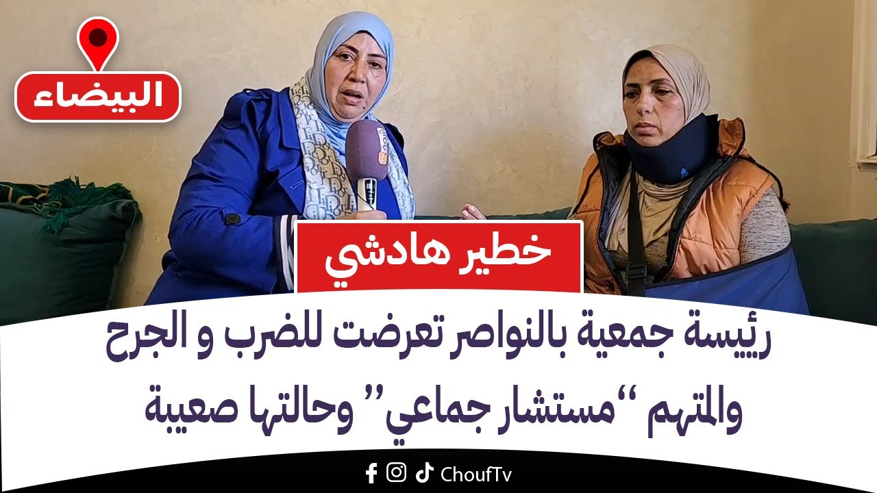 رئيسة جمعية بالنواصر تعرضت للضرب و الجرح والمتهم ’’مستشار جماعي‘‘ وحالتها صعيبة