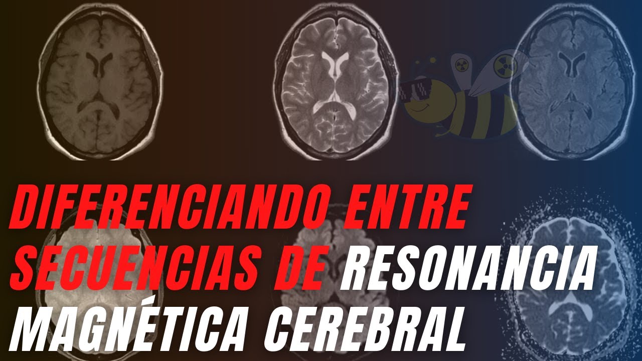 🟣🟡🔴Diferenciando entre secuencias de resonancia magnética cerebral