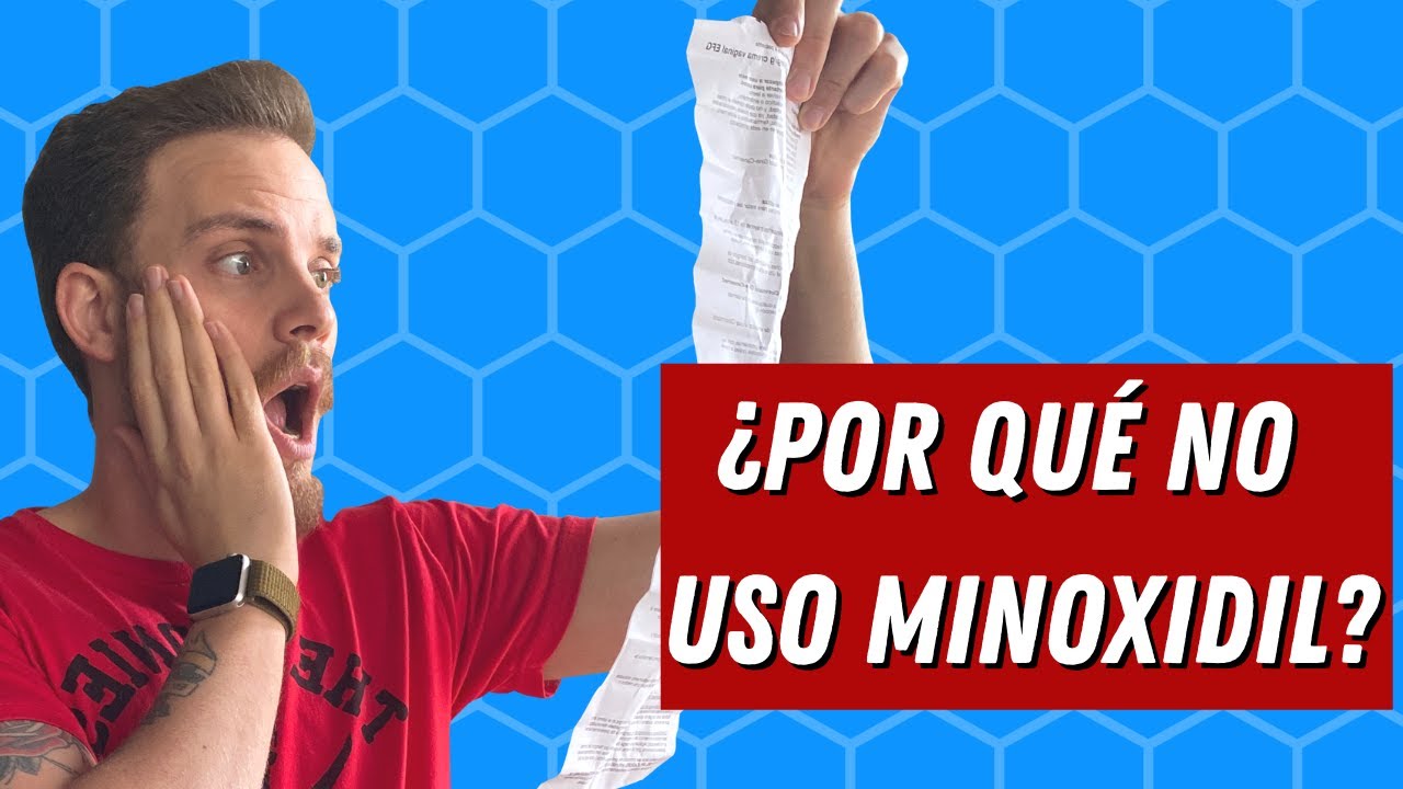 &iquest;Por qu&eacute; no uso Minoxidil oral o t&oacute;pico para la ca&iacute;da de mi pelo?