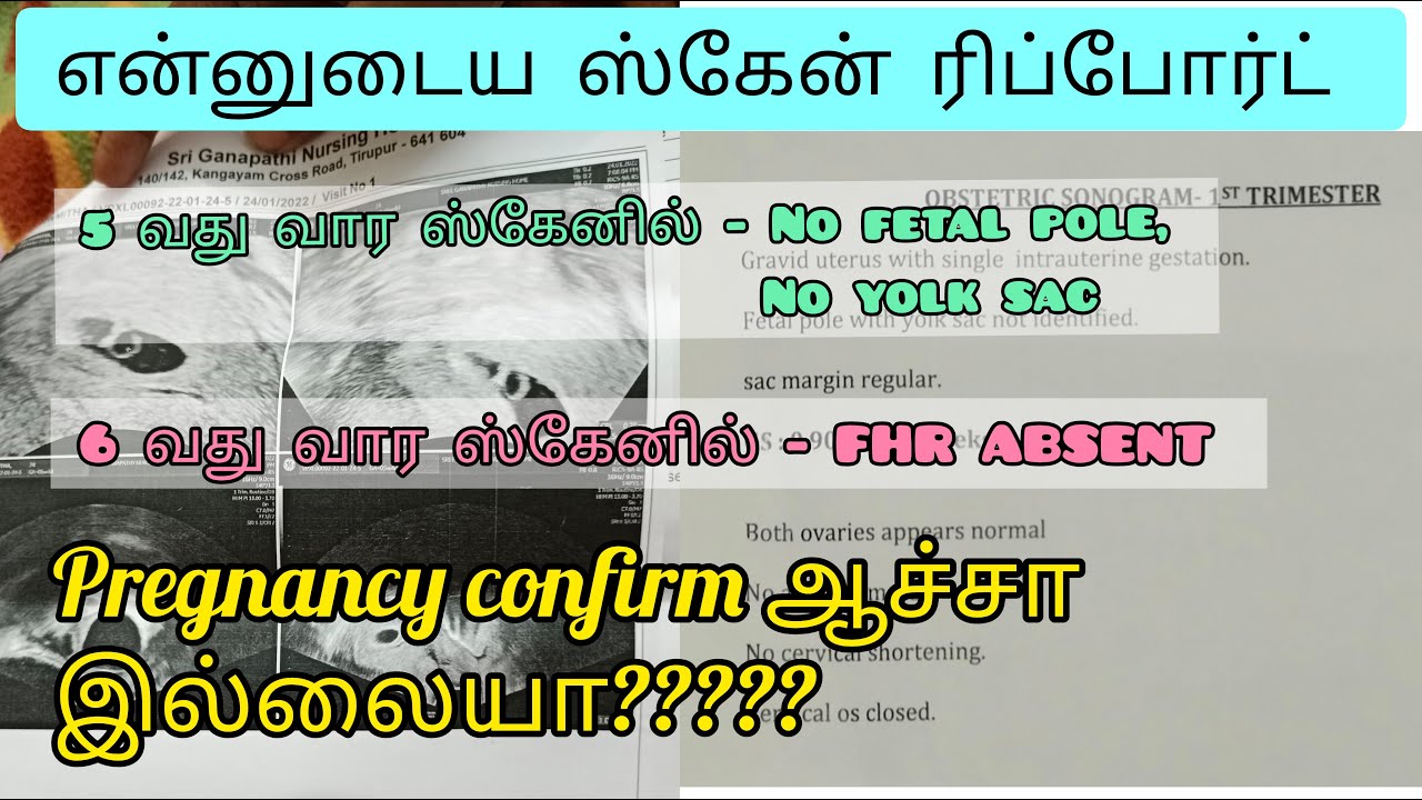 My Pregnancy Scan Report | Fetal pole | Yolk sac | FHR | MOM TO BE TAMIL