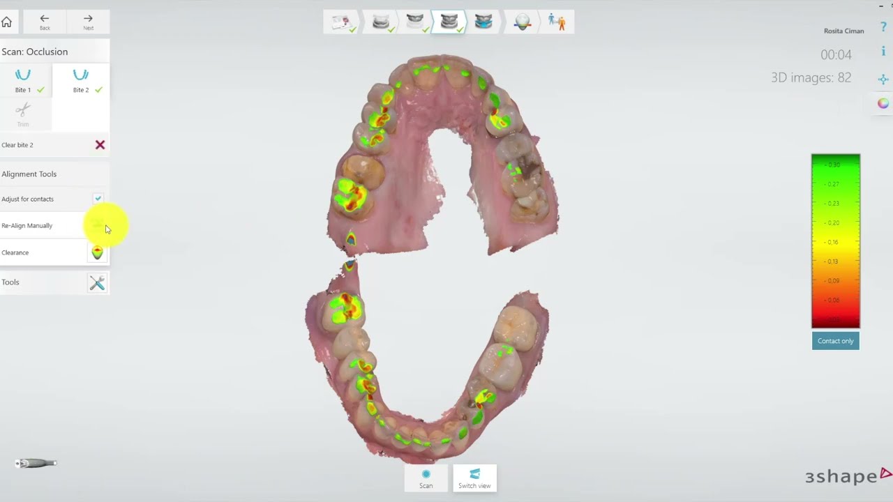 TRIOS 3shape occlusion settings: flag adjust for contacts ?