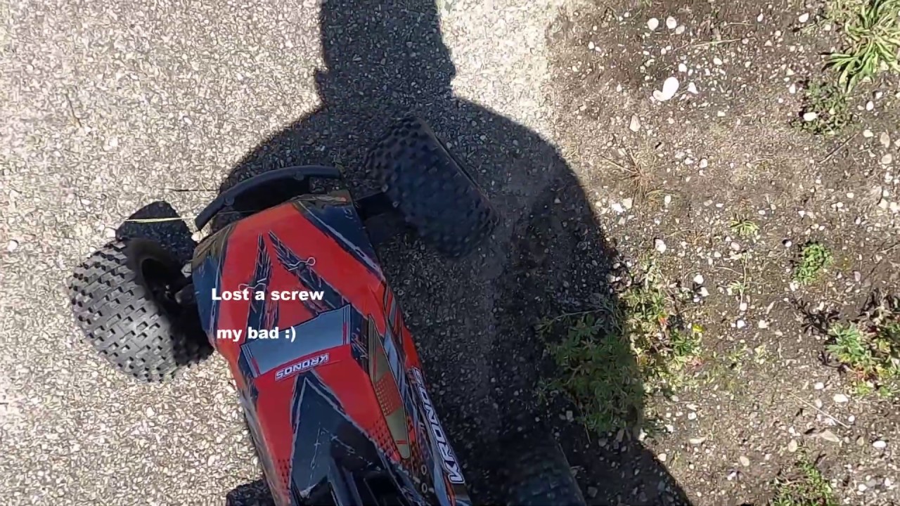 LETS ROCK THE CORALLY KRONOS WITH THE NEW BRACES ! THANKS MR ENGELEN