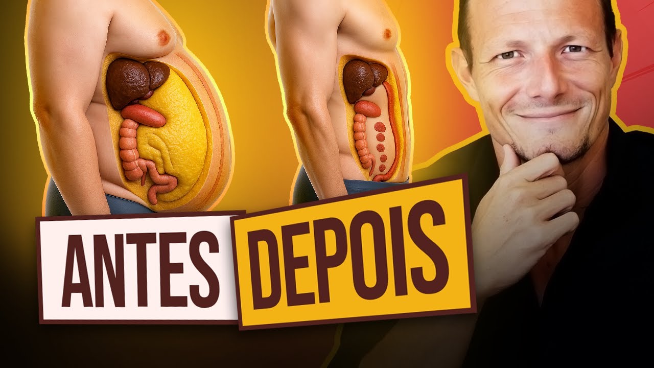 Se Eu Tivesse 20kg Pra Perder, Eu Faria Isso (5 Passos)