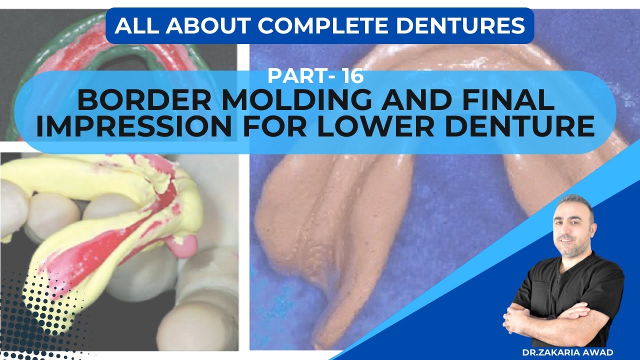 16- طبعة الحواف والطبعة النهائية للأطقم السفلية/ BORDER MOLDING & FINAL IMPRESSION OF LOWER DENTURES