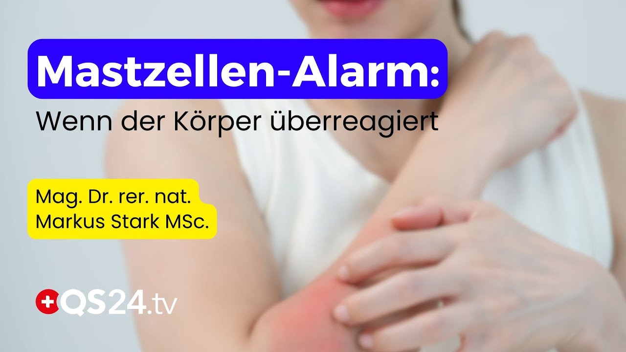 Histaminfalle: Warum dein K&ouml;rper st&auml;ndig auf Alarm schaltet | Naturmedizin | QS24
