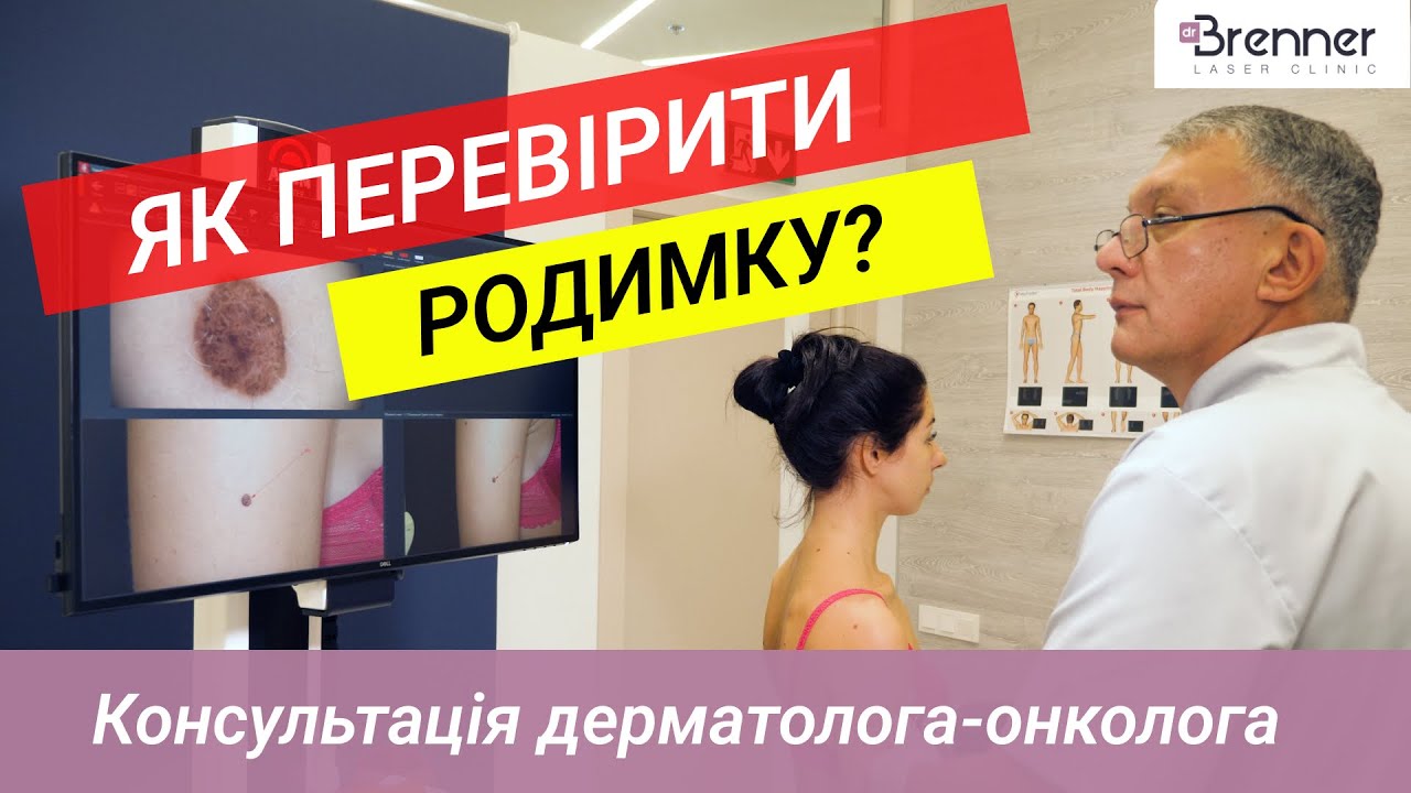Диагностика родинок | Дерматоскопия | Клиника доктора Бреннера