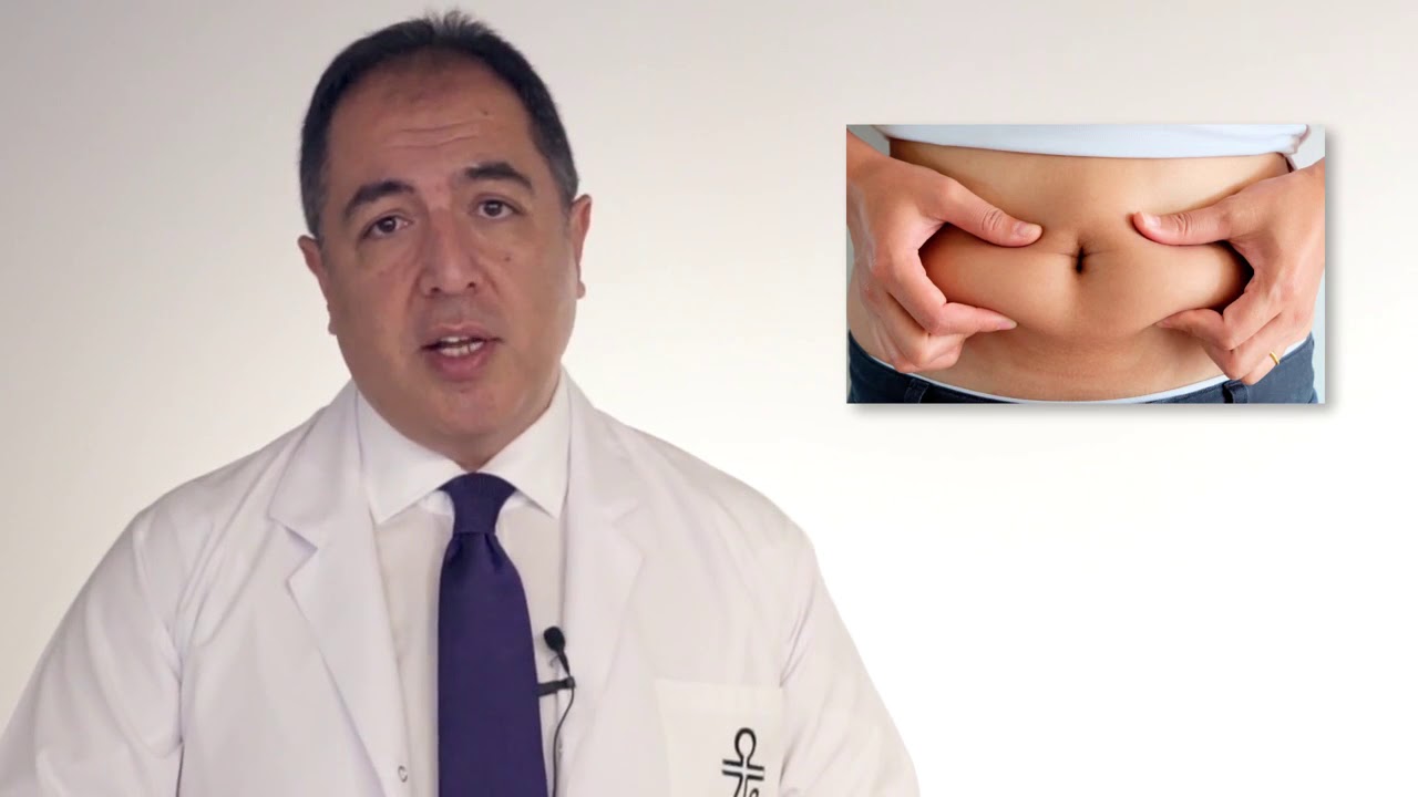 Vaser Liposuction ile Bölgesel Yağlarınızdan Kurtulun - Doç. Dr. Tarık Çavuşoğlu
