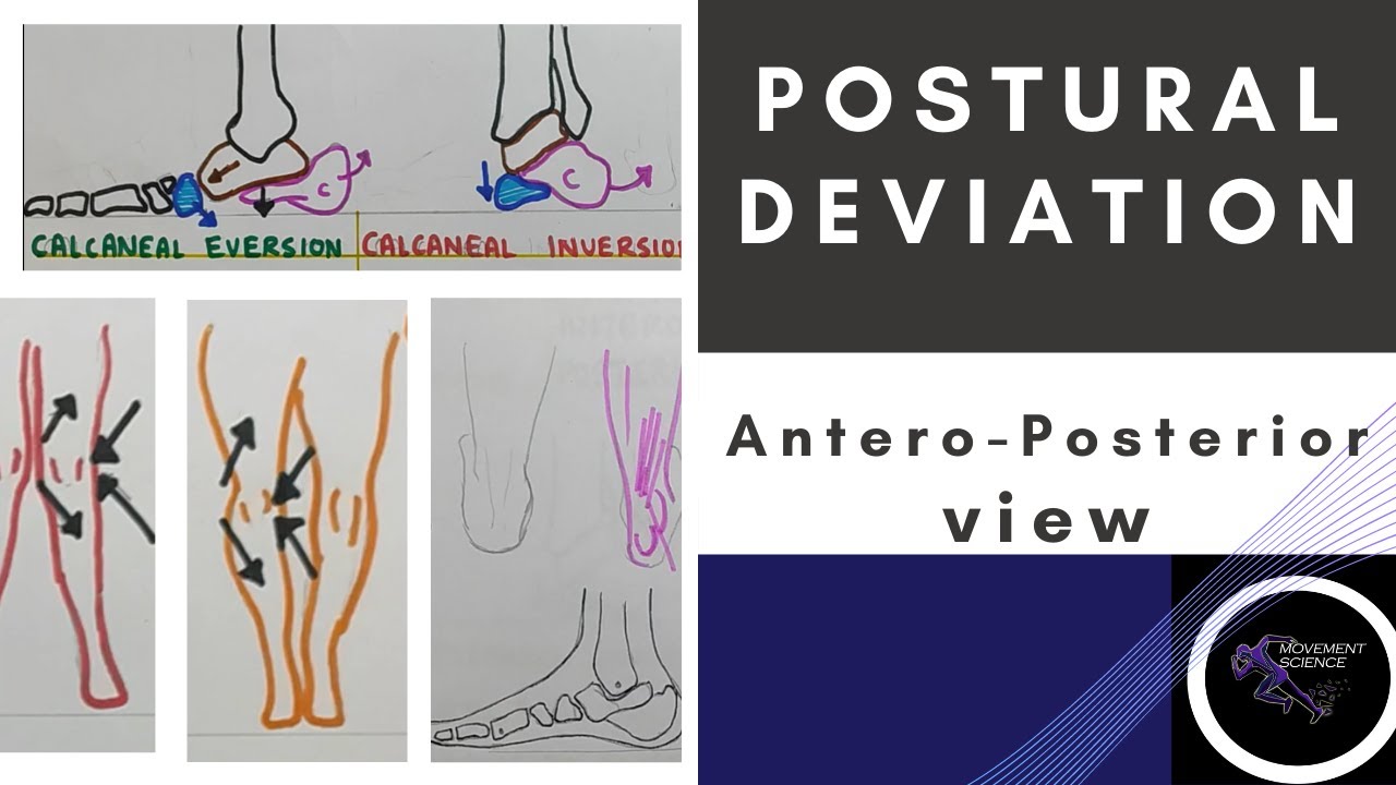 POSTURAL DEVIATION ANTERIO- POSTERIOR VIEW,  LOWER LIMB (Posture Biomechanics)Physiotherapy Tutorial