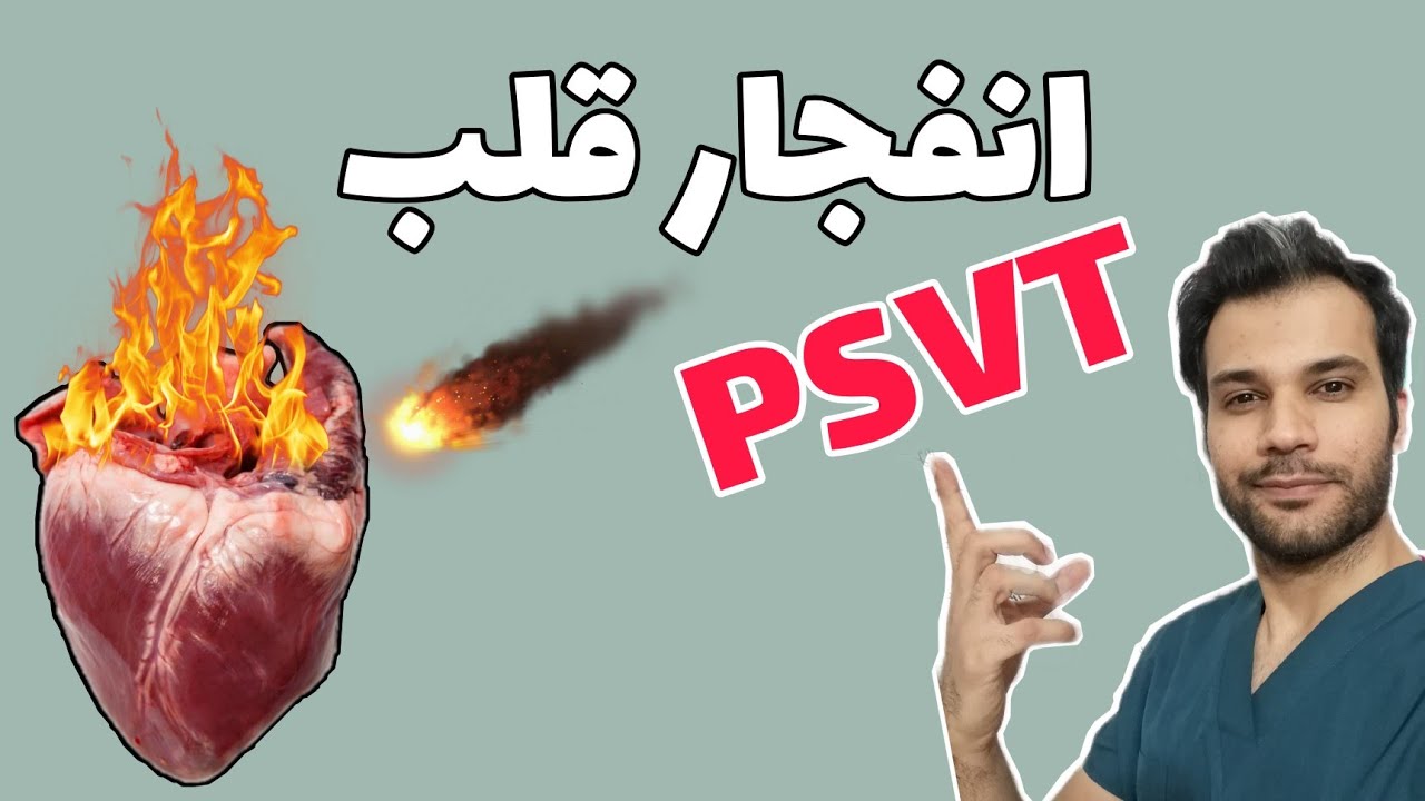 تپش شدید قلب!... psvt تاکی کاردی قلبی