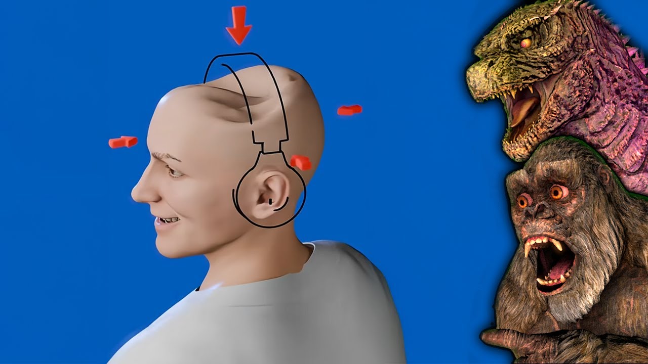 He Wore His Headphones For 20 HOURS