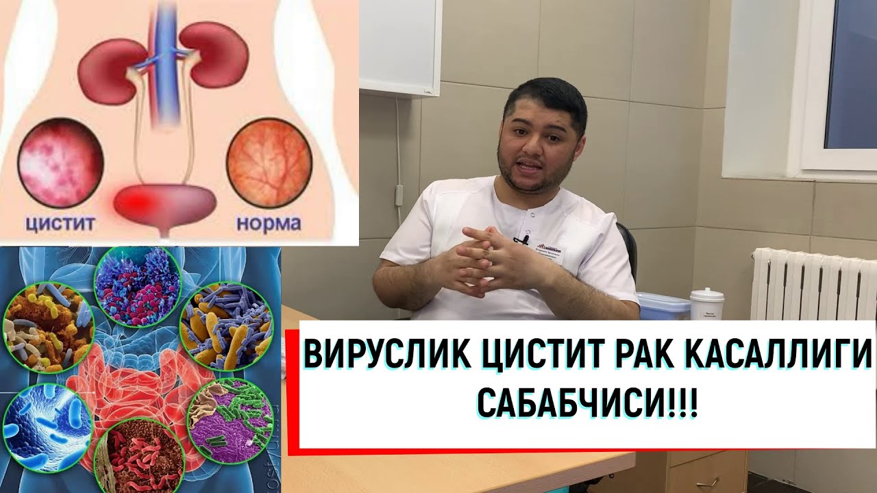 ЦИСТИТ КАСАЛЛИГИ ВИРУСДАН БУЛГАН САБАБЛАРИ ВА РАК КАСАЛЛИГИ