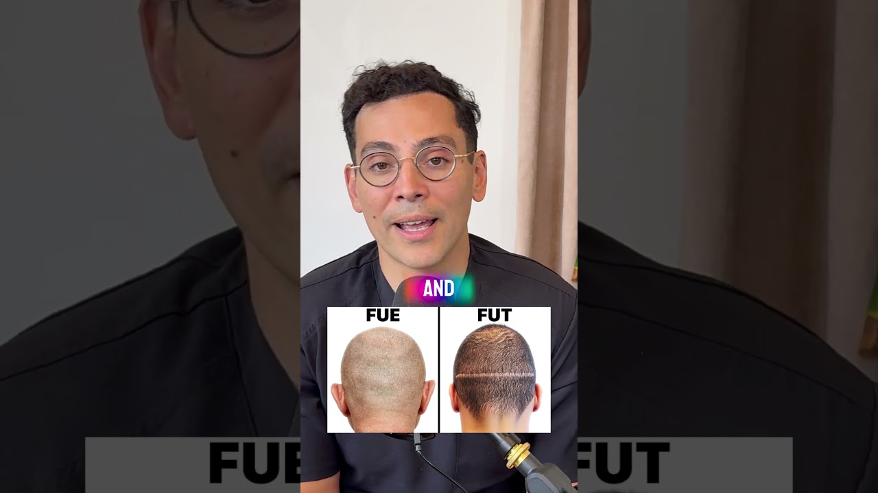 The Real Difference Between FUE and FUT Hair Transplants &ndash; Doctor Explains
