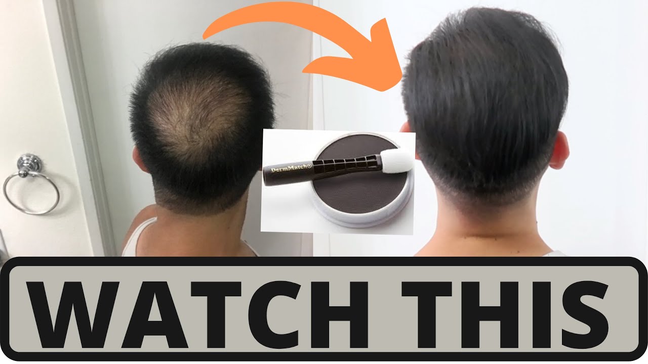 How To Apply DermMatch