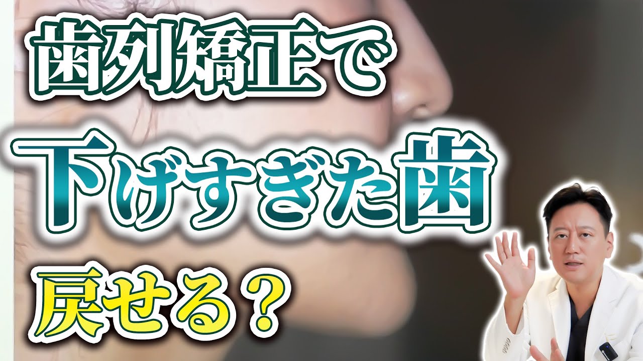歯列矯正で口元を下げすぎたら戻せる？Eラインと横顔で後悔しないために知るべきこと【審美歯科 歯列矯正 歯並び】