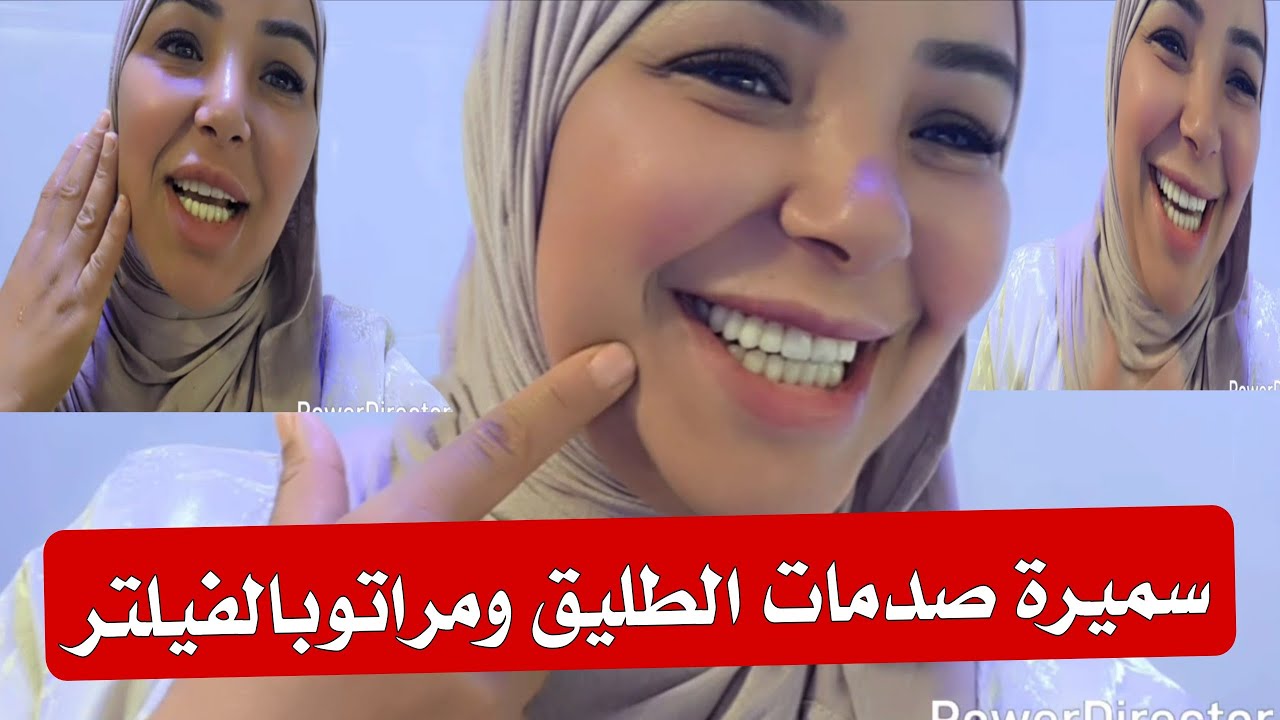 😱🔥 سميرة صدمات الطليق ومراتو… الفلتر فضحهم وهي ورّات الجمال الطبيعي ديالها 😍