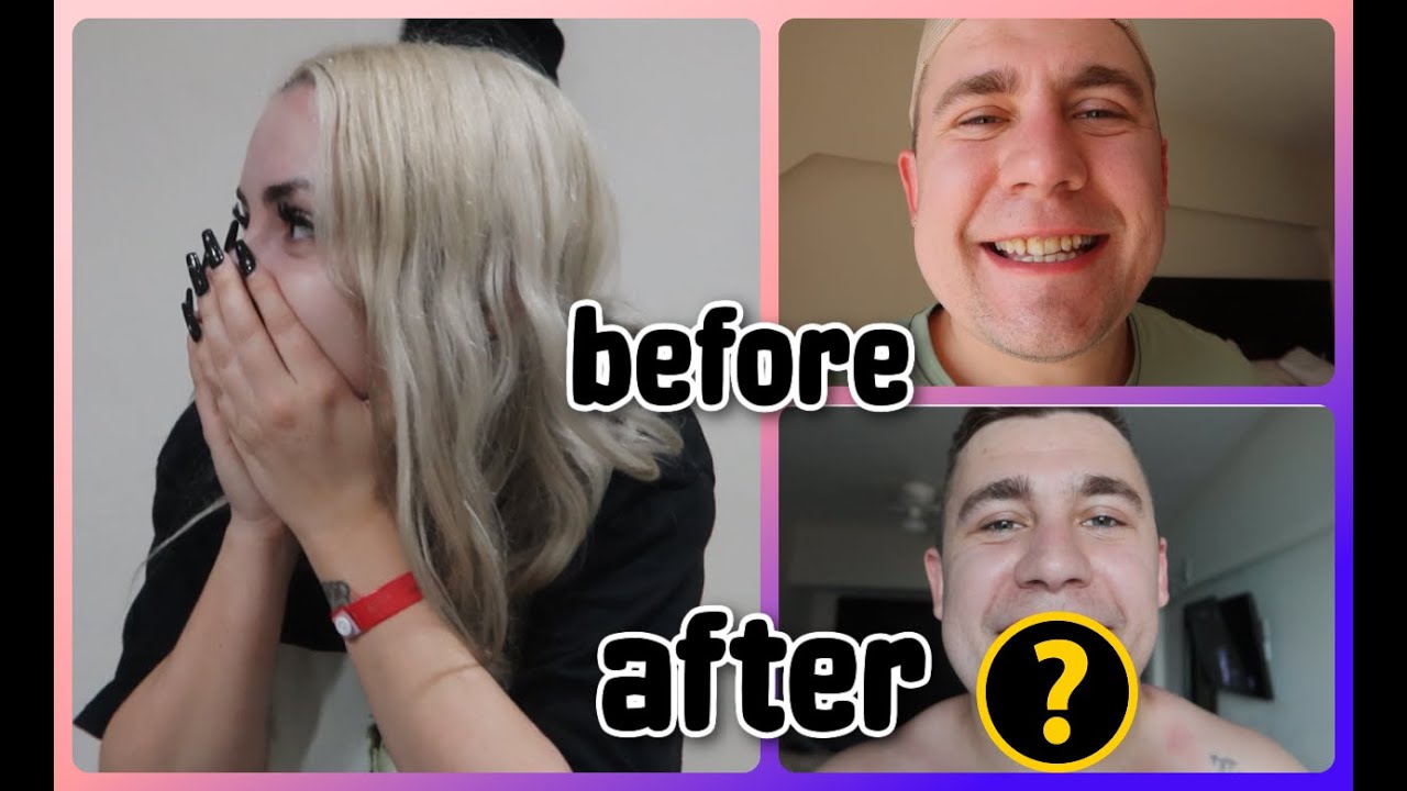 My BOYFRIEND got cosmetic surgery in MEXICO!!