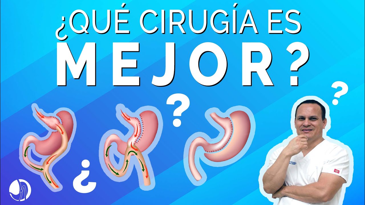 QUE CIRUGÍA ES MEJOR 🤔 | DR. OMAR FONSECA.